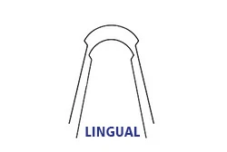 Lingual Arches Lingual Arches