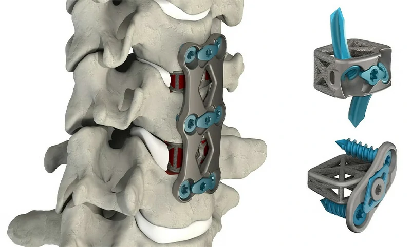 Dispositivos médicos