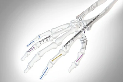 Grade 23 titanium self tapping screws